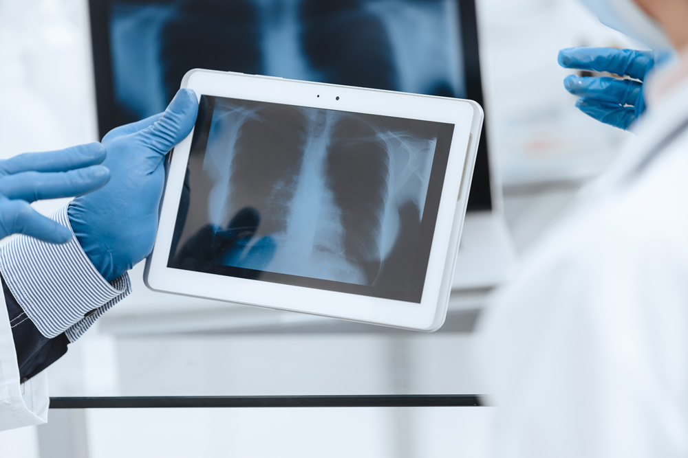 close-up x-ray lungs screen digital tablet